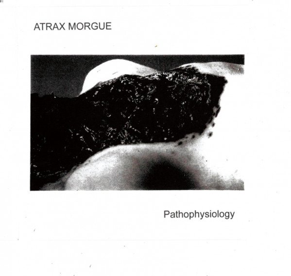CD Shop - ATRAX MORGUE PATHOPHYSIOLOGY